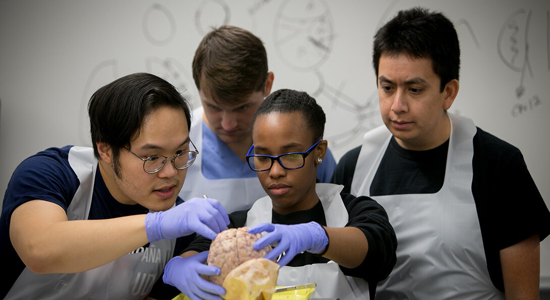 Students examine a brain model