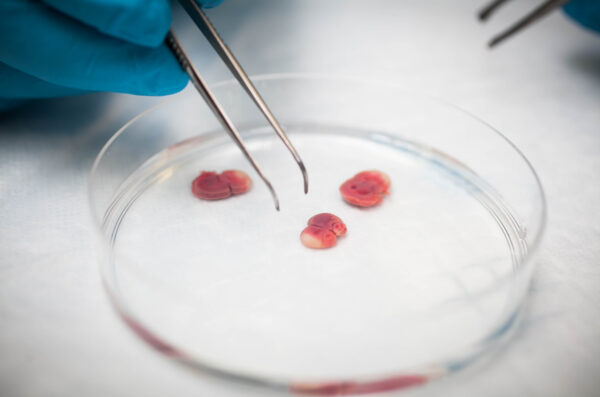 Tweezers manipulate specimen in petri dish