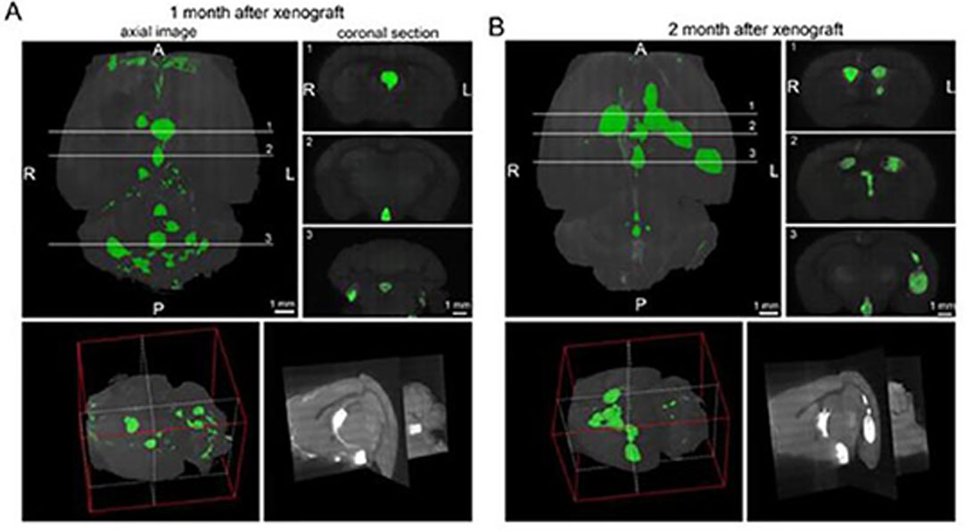 3D imaging of the mice brain
